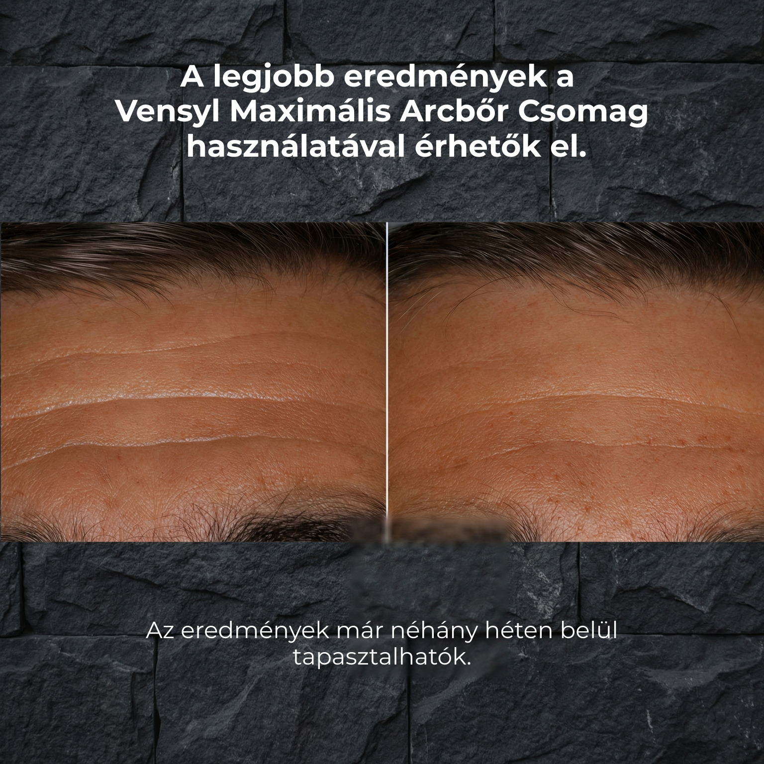 Aurum Azonnali Hidratáló
